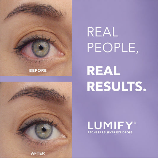 LUMIFY gotas oftálmicas, envase de 7,5 ml
