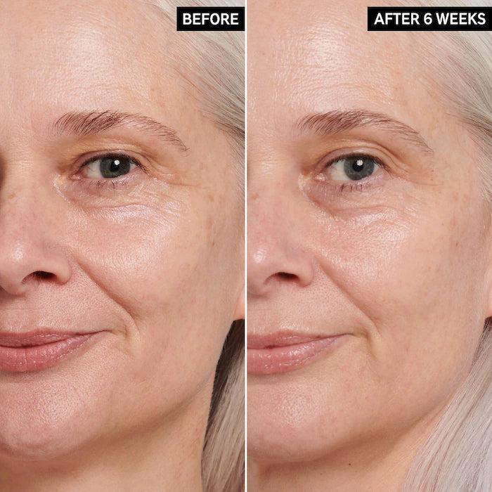 Contorno de ojos de retinol The Inkey list