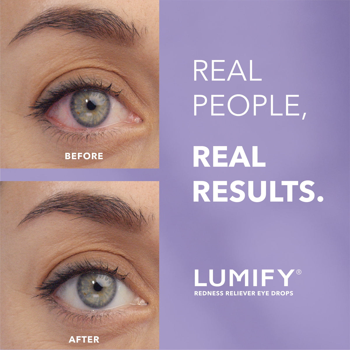 LUMIFY gotas oftálmicas, envase de 7,5 ml